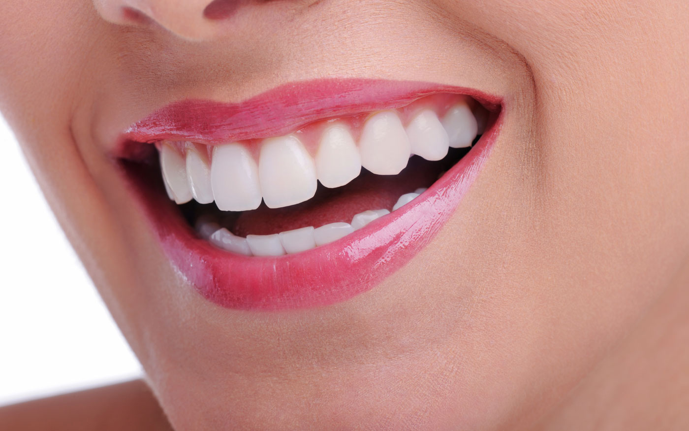 Teeth Whitening - Llandovery Dental Practice